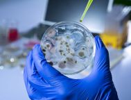 MEN VI SINH XỬ LÝ NƯỚC THẢI